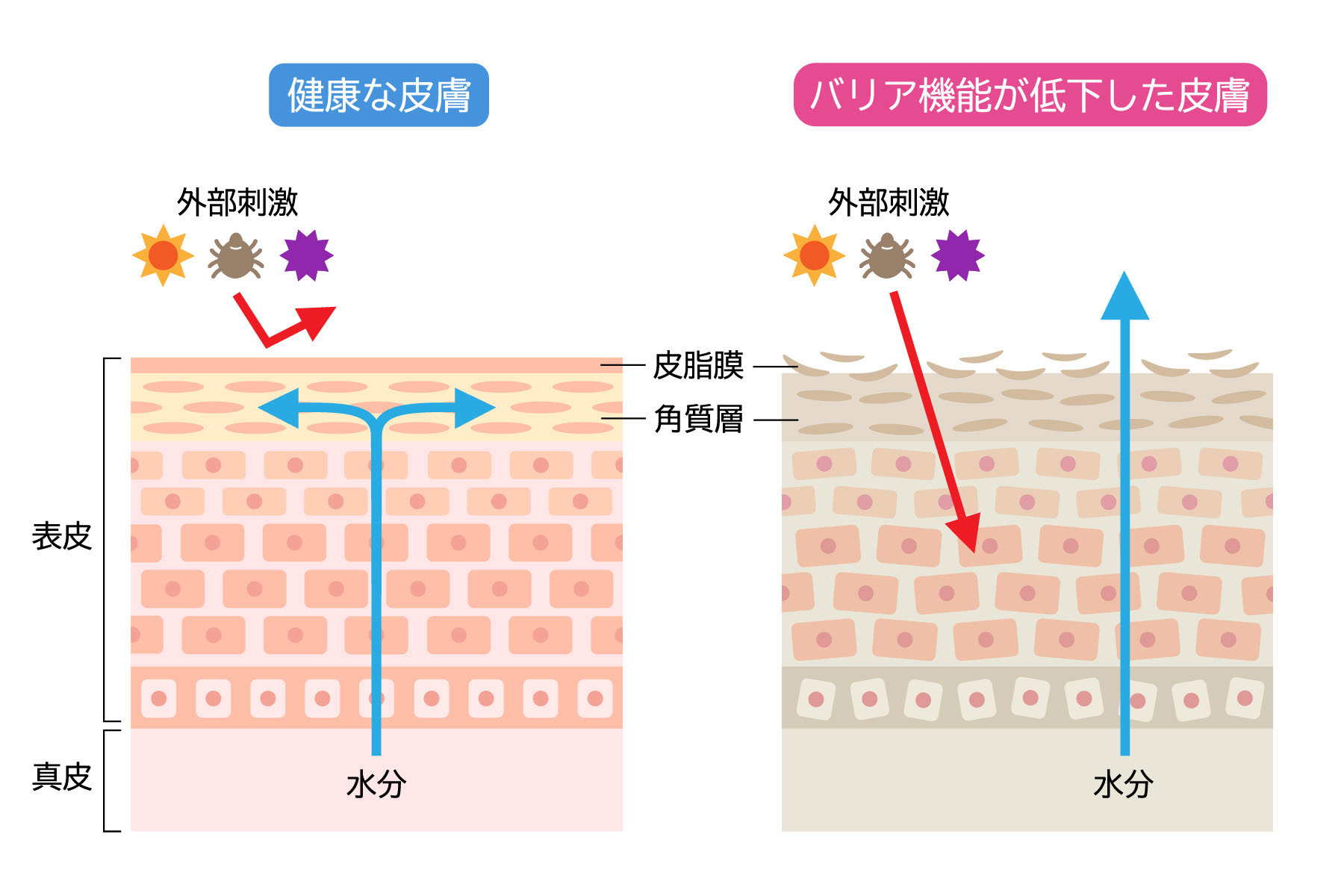 正常な肌とアトピー肌の比較（バリア機能と免疫反応のイメージ）