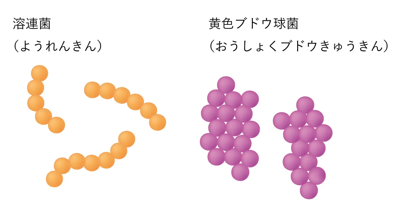 黄色ブドウ球菌と溶連菌のイラスト