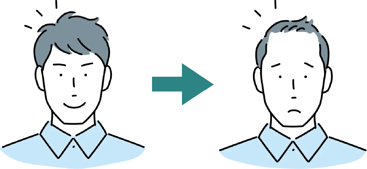 AGAに悩む男性のイメージ