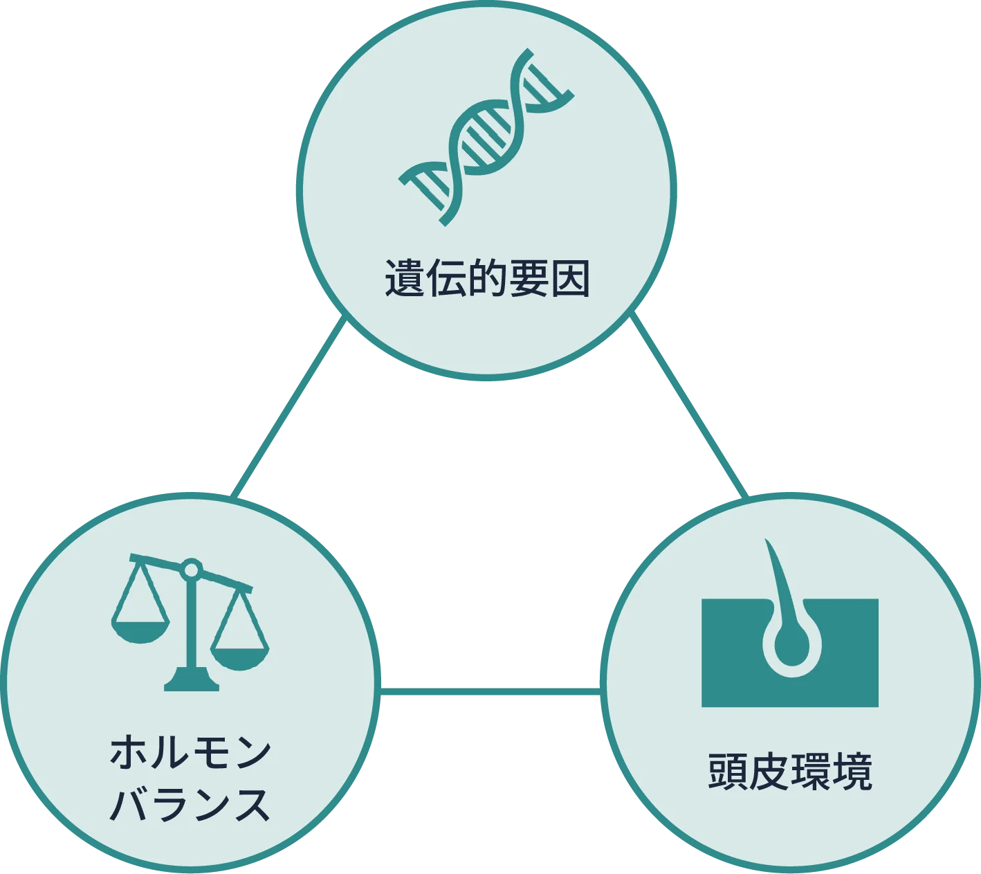 AGAの要因３つを説明したイラスト