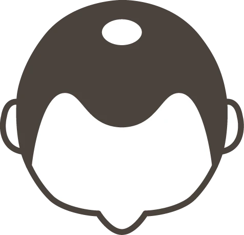 AGAの薄毛パターンのO字型のイメージイラスト