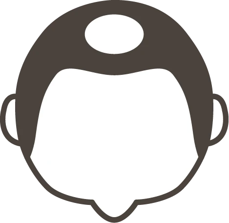 AGAの薄毛パターンのU字型のイメージイラスト