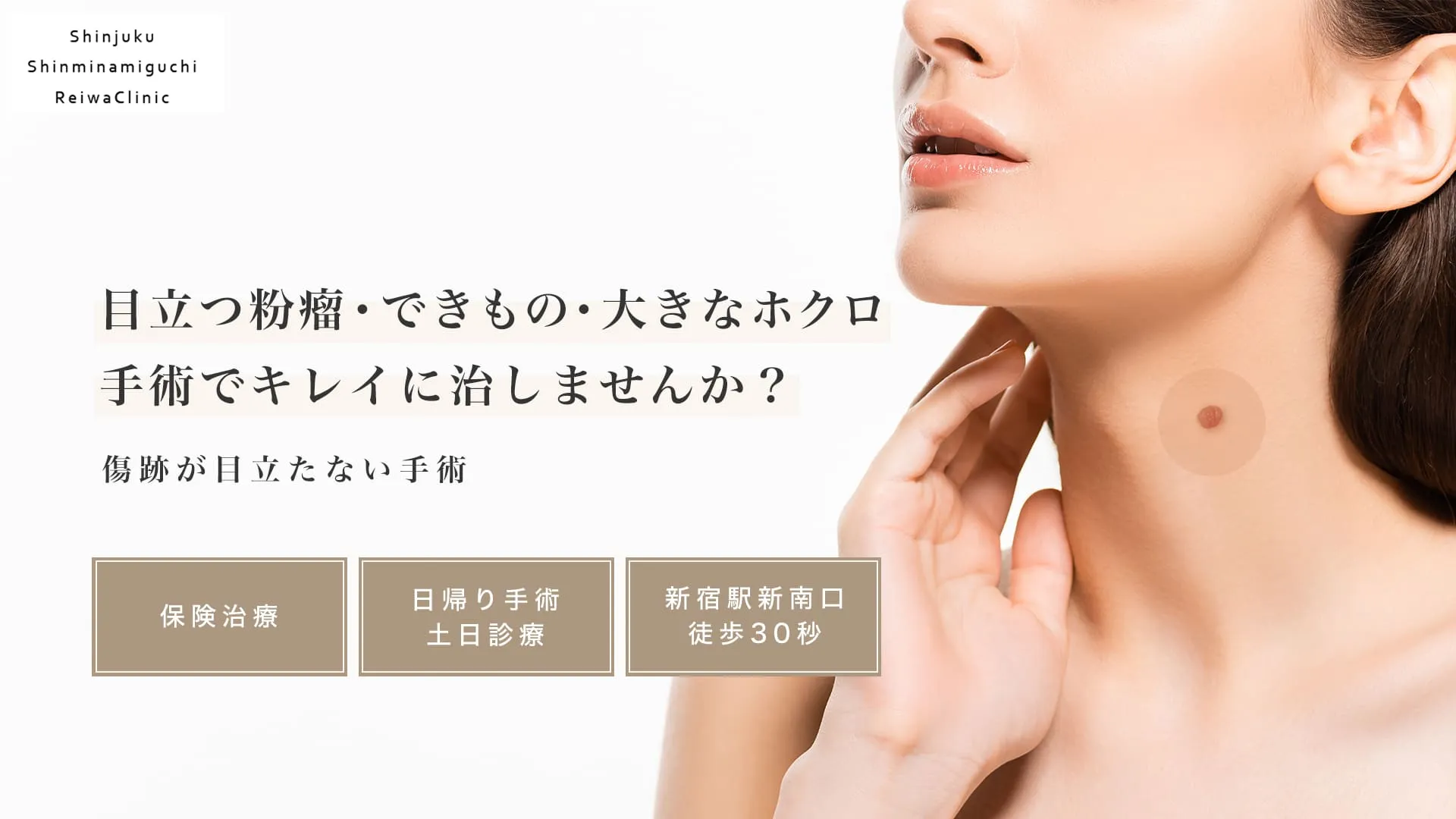 れいわクリニック。目立つ粉瘤・できもの・ホクロの傷跡が目立たない日帰り手術。新宿駅新南口徒歩30秒。