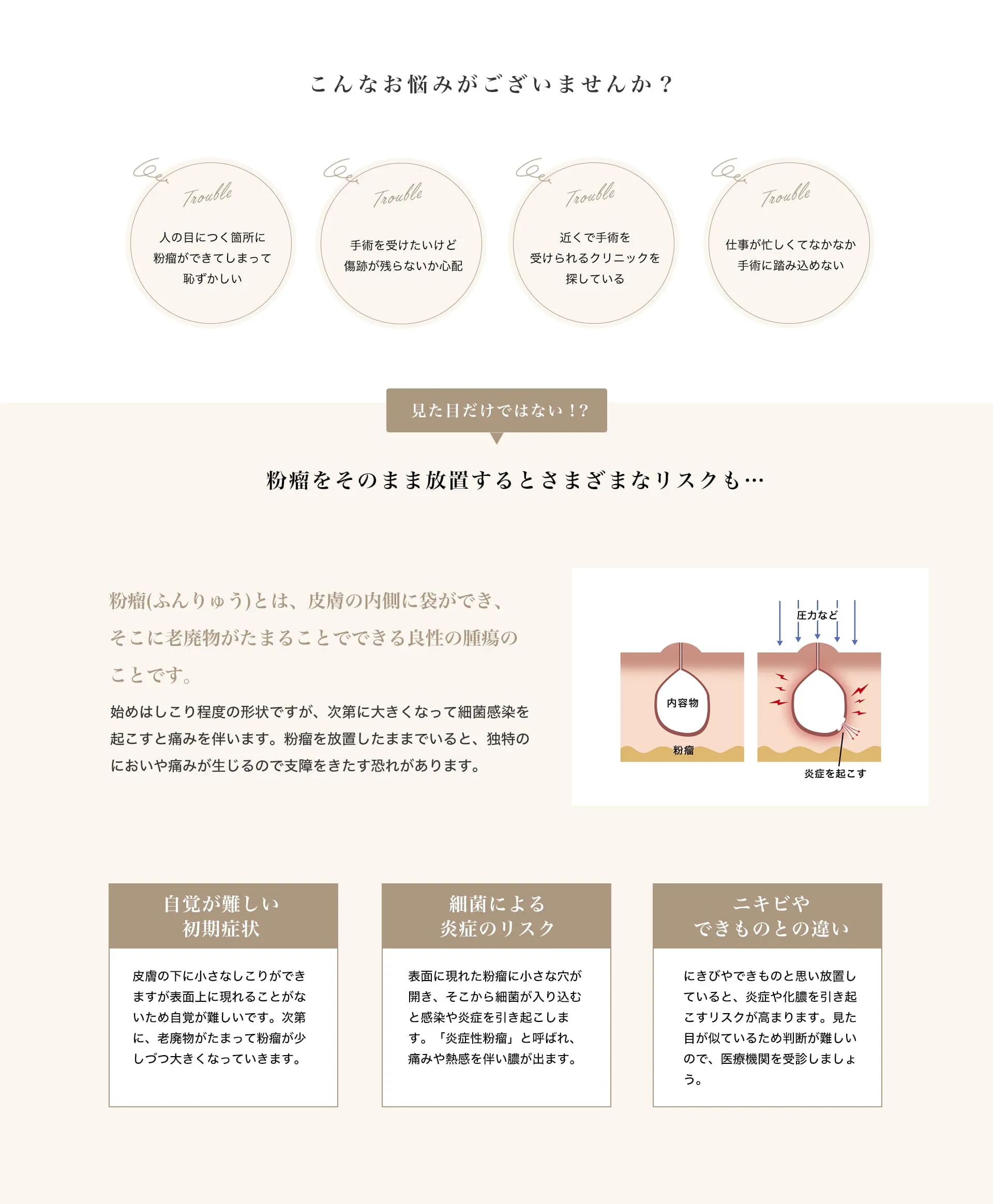 粉瘤を放置するリスクと、ニキビとの違いについて。