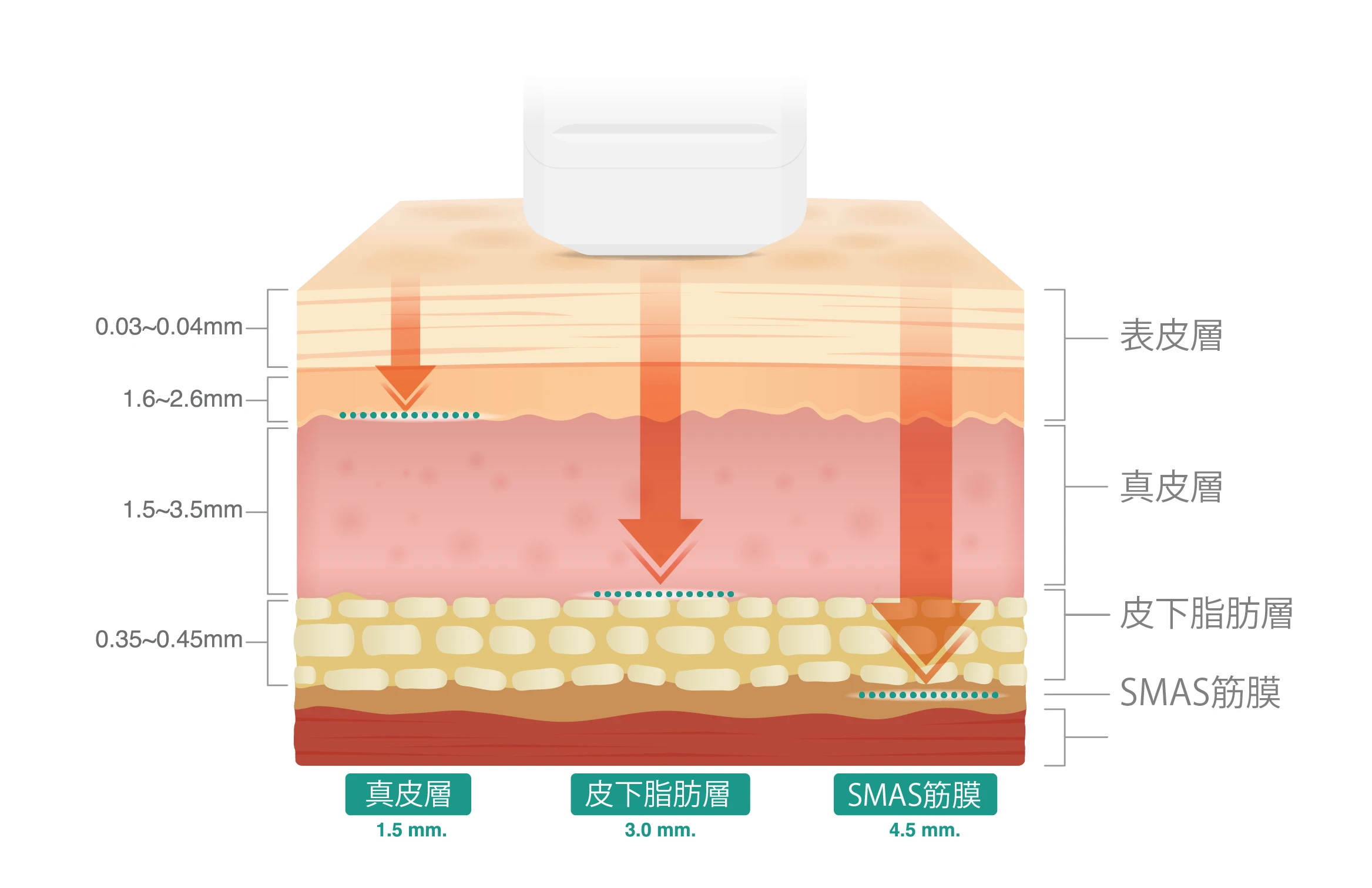 皮膚組織の断面図