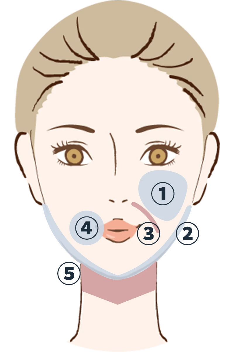 施術範囲の詳細イラスト