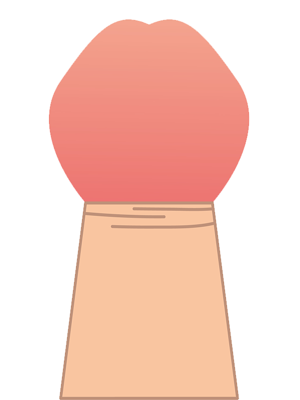 カントン包茎のイメージ図