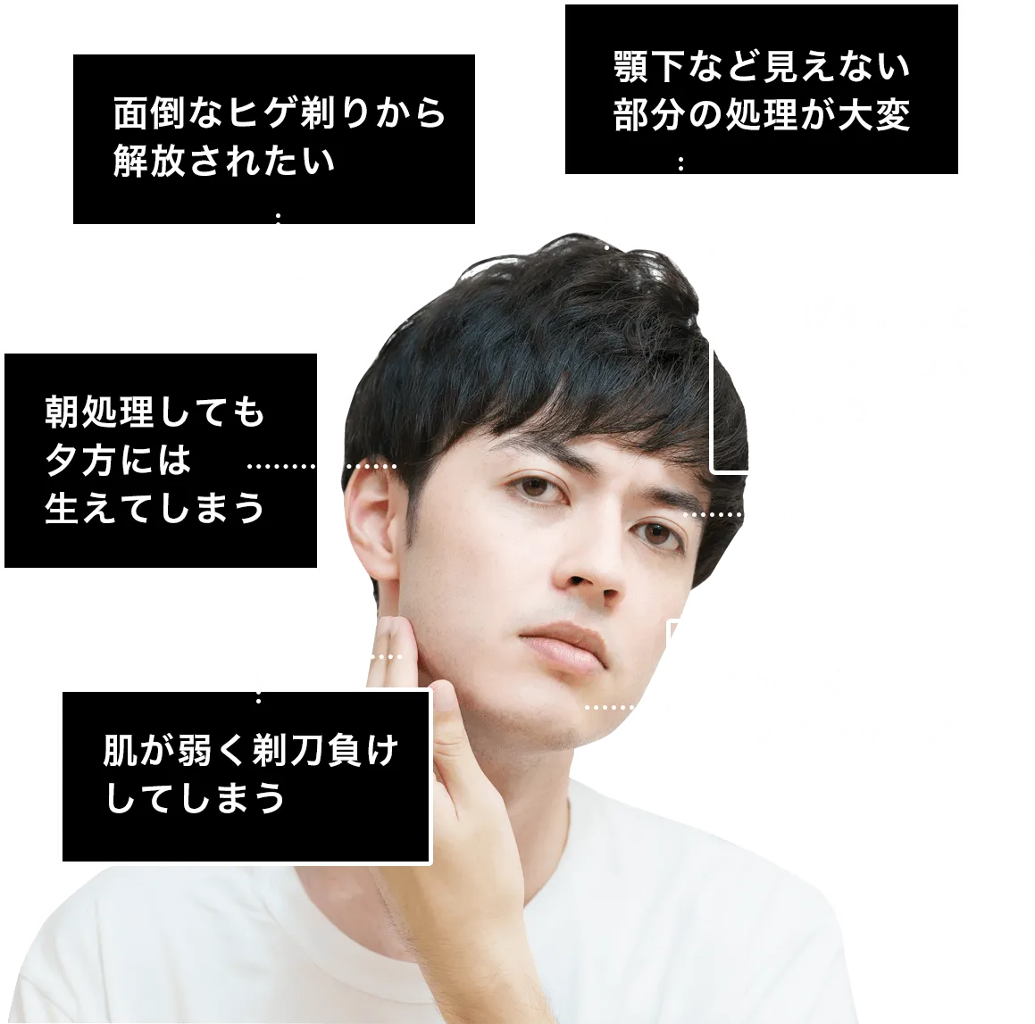 面倒なヒゲ剃りから解放されたい。顎下など見えない部分の処理が大変。朝処理しても夕方には生えてしまう。ひげを剃ると青髭になってしまう。肌が弱く剃刀負けしてしまう