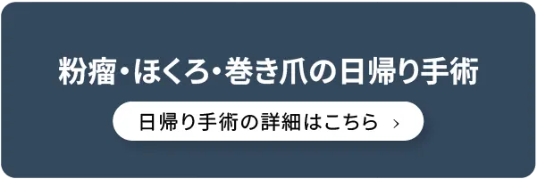 粉瘤・ほくろ・巻き爪の日帰り手術