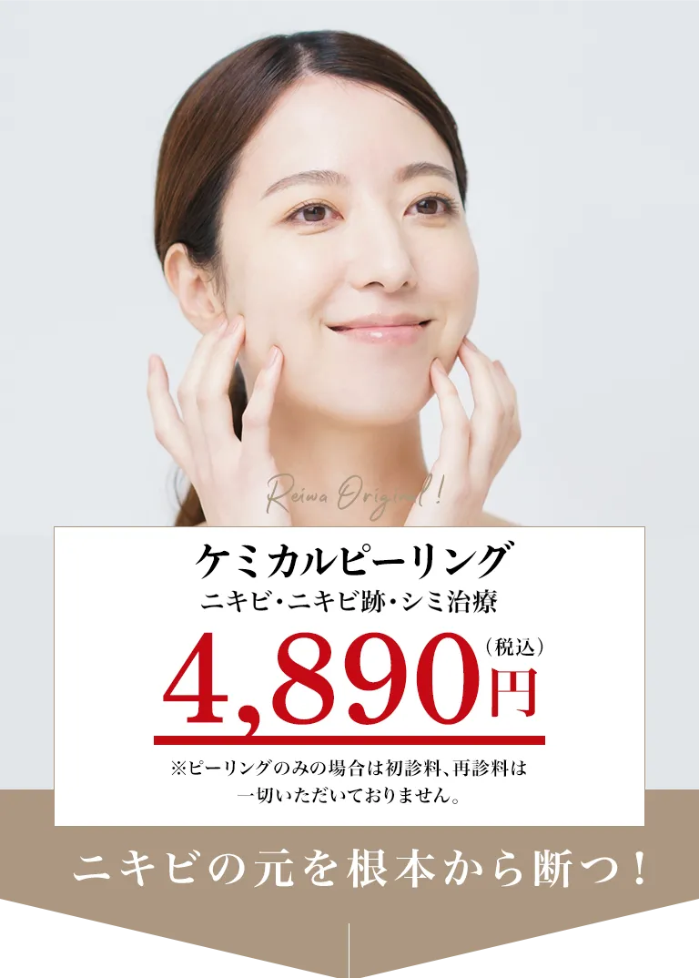 ニキビ・ニキビ跡・シミ治療 5,400円（税込）※ピーリングのみの場合は初診料、再診料一切いただいておりません。