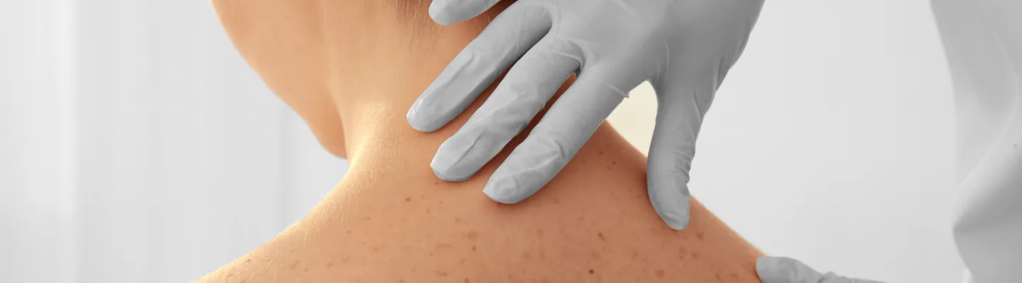 【医師監修】稗粒腫（はいりゅうしゅ）の除去・保険診療｜新宿れいわクリニック