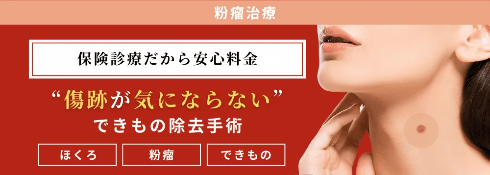 保険診療での粉瘤・ほくろ・できもの除去手術