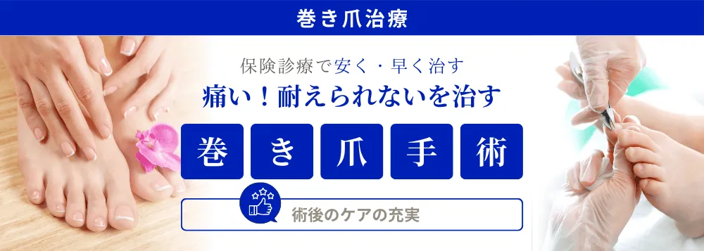 痛い巻き爪を治す 巻き爪手術（保険診療対応）
