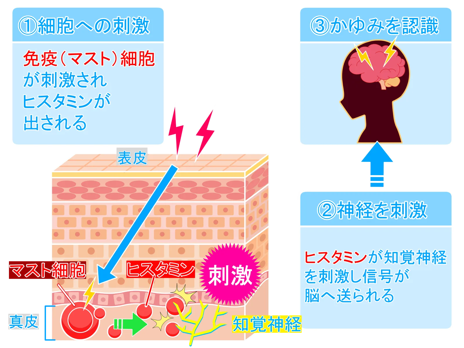 かゆみが発生する3ステップの仕組み：①免疫細胞（マスト細胞）からヒスタミンが放出 ②ヒスタミンが知覚神経を刺激 ③脳にかゆみの信号が伝わり認識する図解