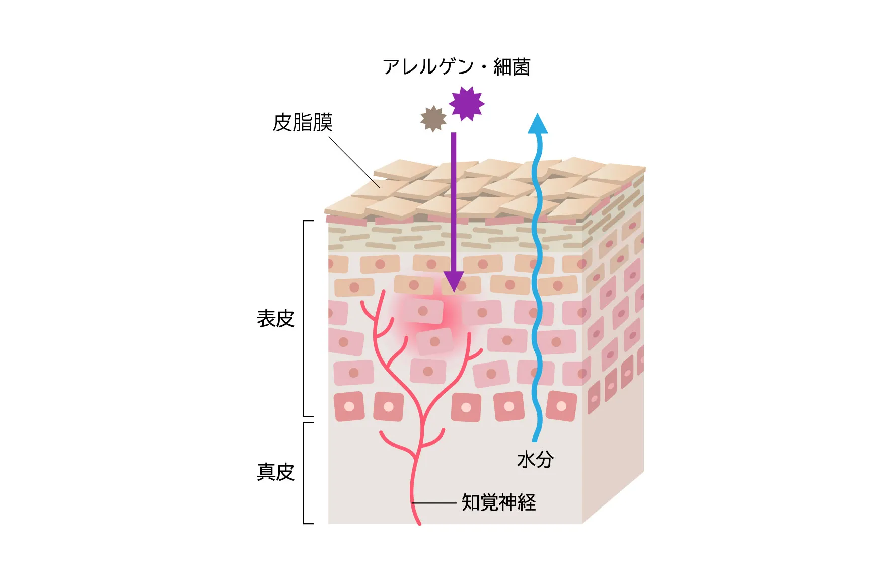 バリア機能が低下した皮膚の断面図。皮脂膜の減少により、アレルゲンや細菌が侵入し、内部の水分が蒸発している様子。