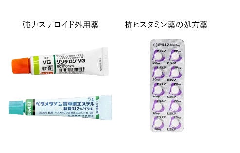 皮膚科で処方される代表的な虫刺され薬（リンデロンVG・ベタメタゾン・ビラノア）