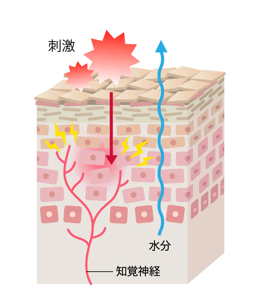 乾燥した皮膚の断面イラスト。角質層のバリアが乱れて水分が逃げ出し、外部刺激が侵入しやすくなっている。