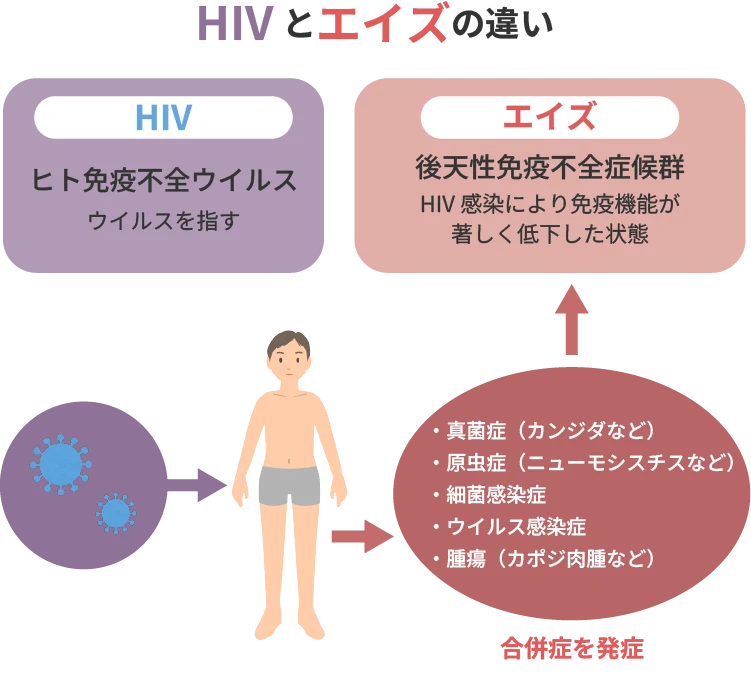 HIV(エイズ)とは?症状・感染経路・検査・治療を医師が解説|新宿・渋谷の泌尿器科なられいわクリニック