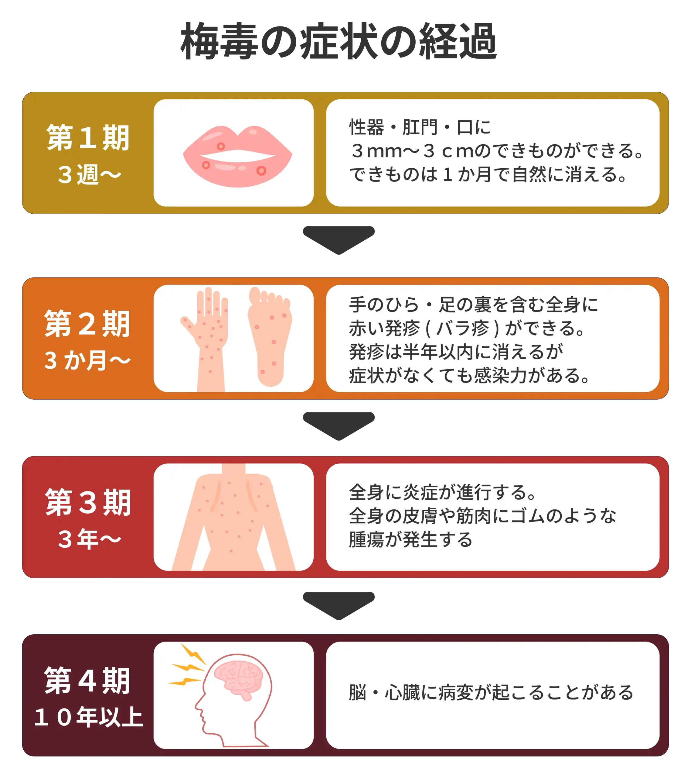 主な性感染症の1つである梅毒の症状の経過を表す表(1期~4期)