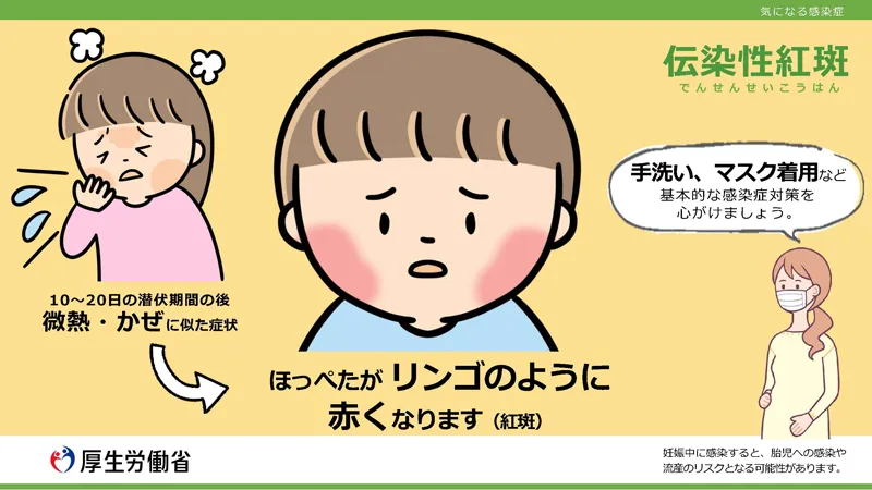 厚生労働省の伝染性紅斑(りんご病)啓発画像