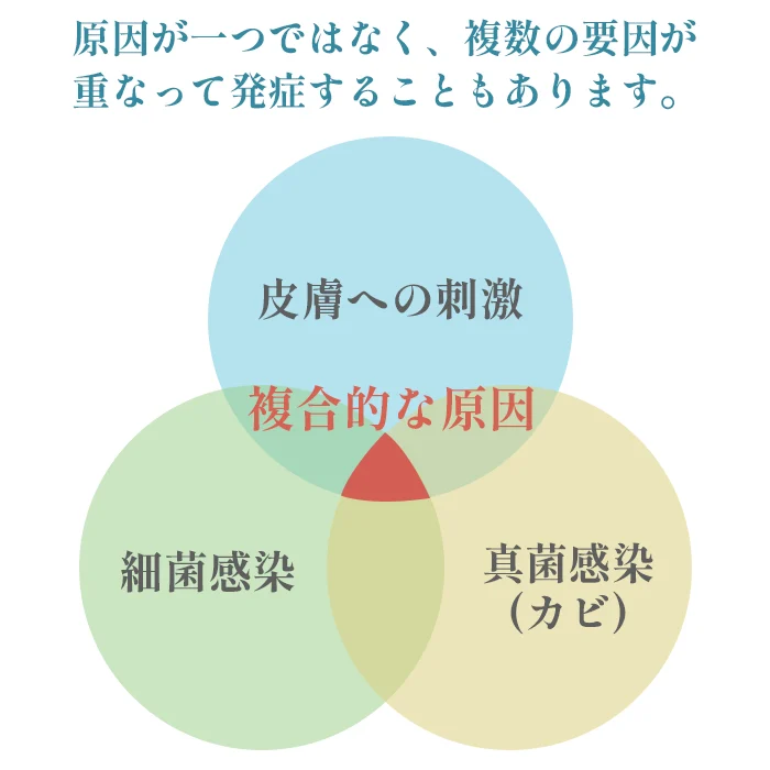 亀頭包皮炎の原因が１つでなく複数にわたる場合があることを表す