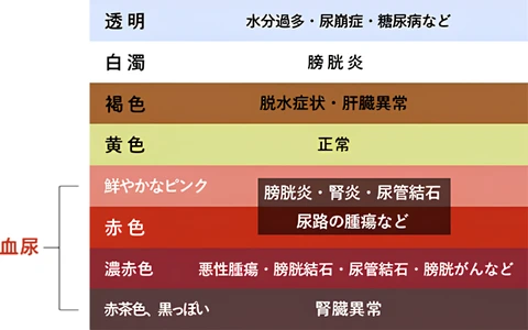 血尿スケール