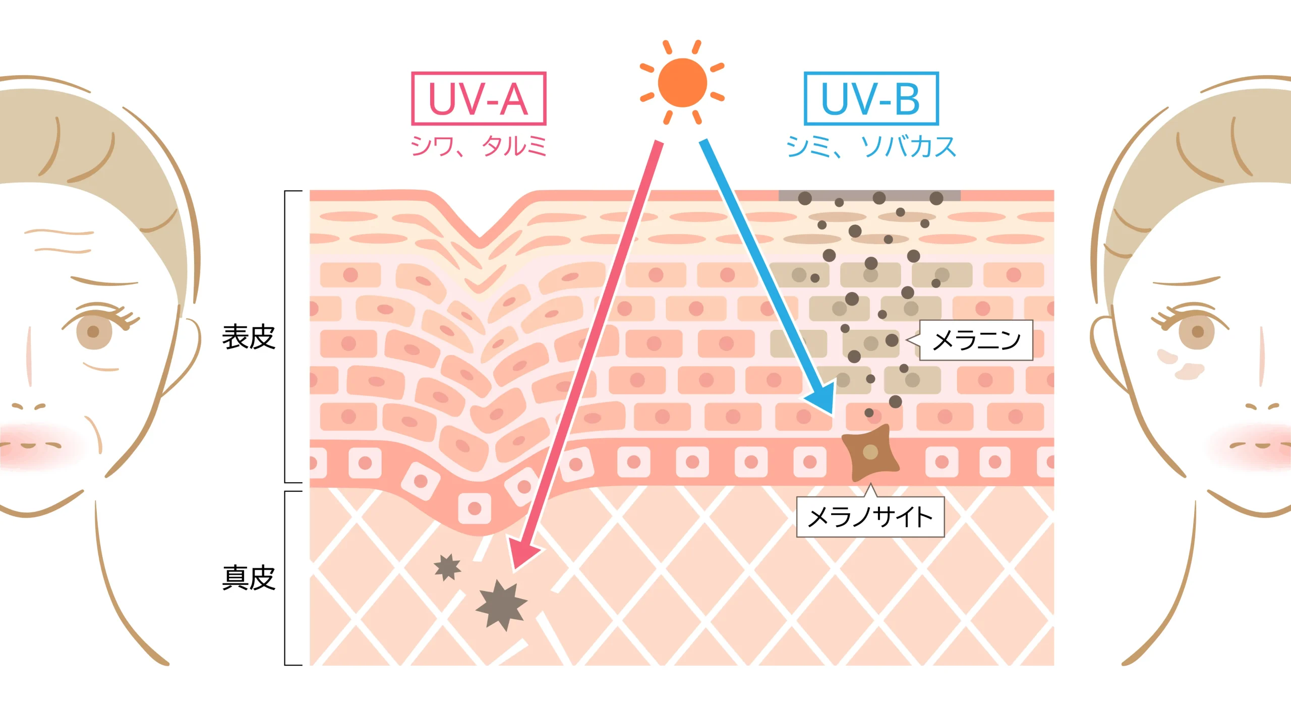紫外線UV-AとUV-Bの到達深度と肌（表皮・真皮）への影響