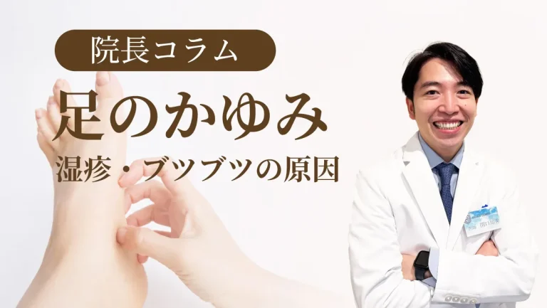 院長コラム足の痒み
