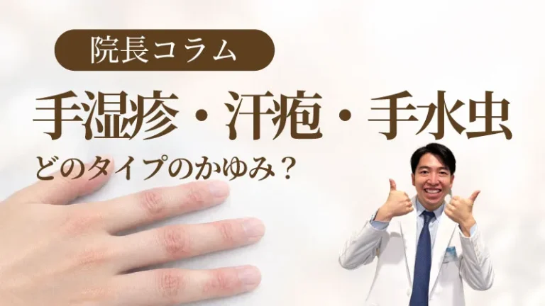 院長コラム 手や指のかゆみ