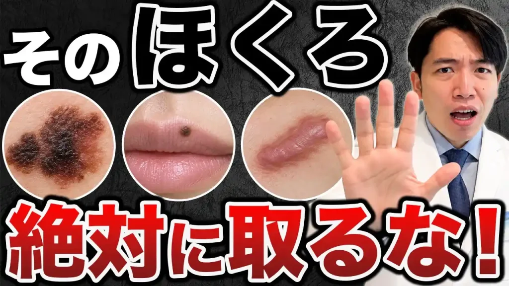 取ってはいけないほくろサムネ