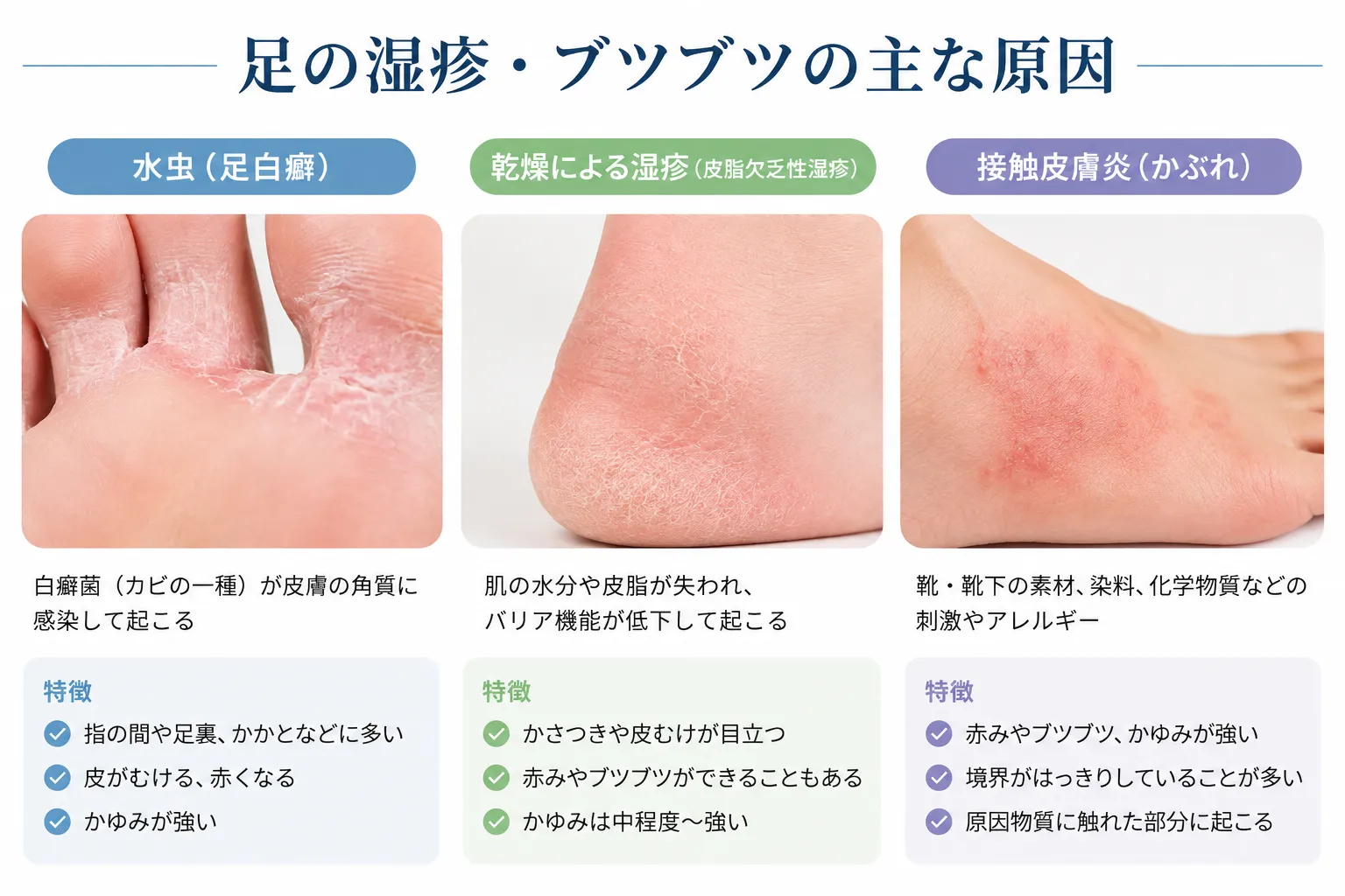 足の湿疹水虫、乾燥、かぶれの比較図
