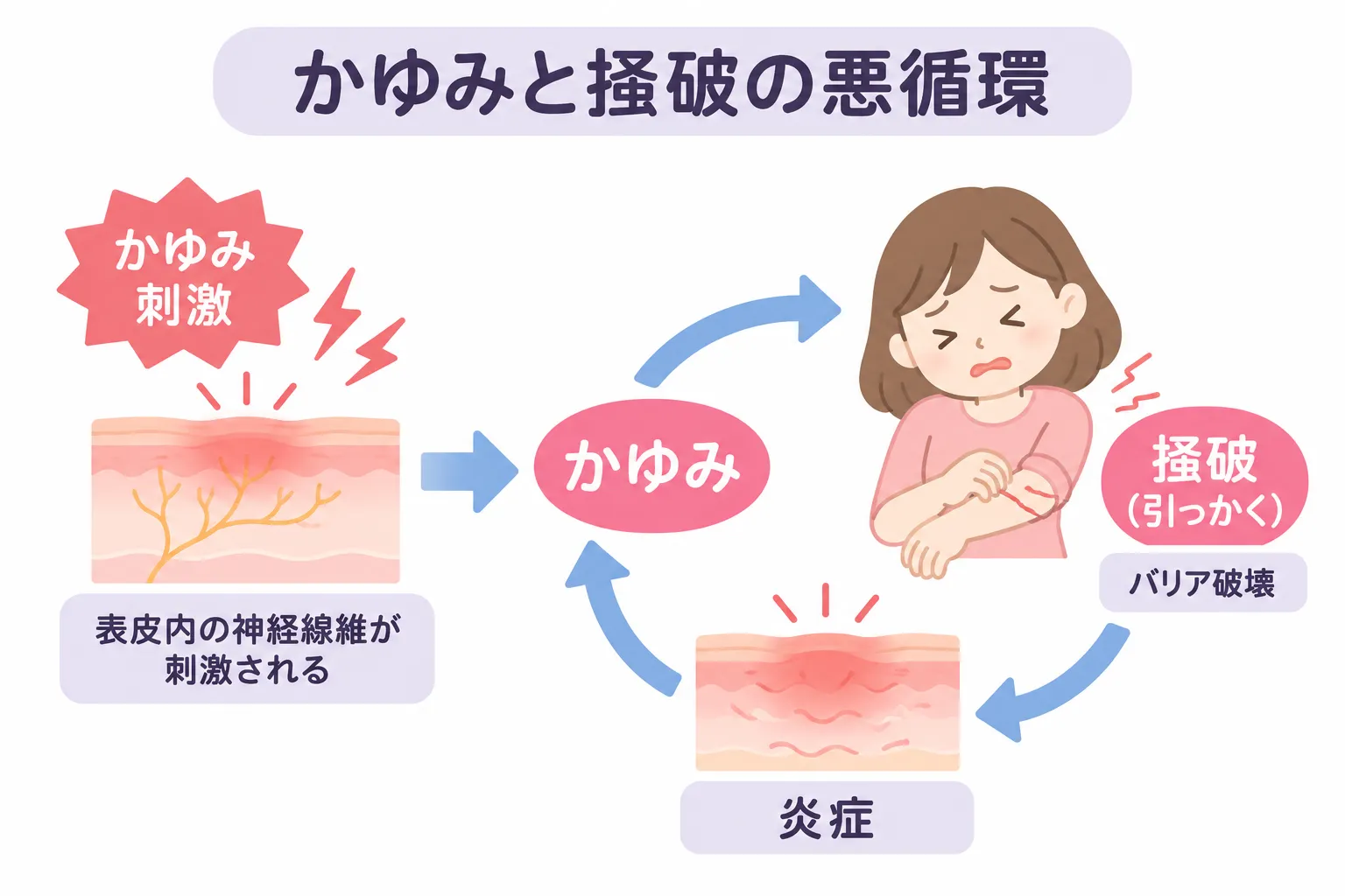 手湿疹のかゆみと掻破の悪循環