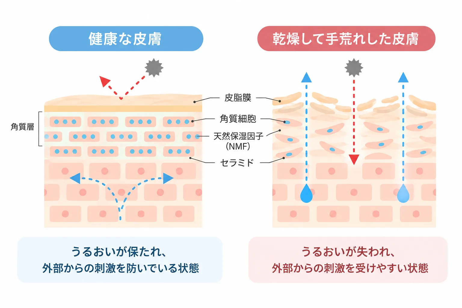 健康な皮膚と乾燥して手荒れした皮膚のバリア機能の違い