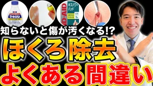 ほくろ除去後のケアについてのサムネ