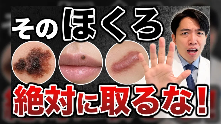 取ってはいけないほくろに関するサムネイル