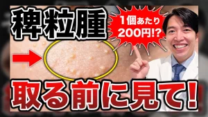 目の周りの白いプツプツ（稗粒腫）について関口院長が解説