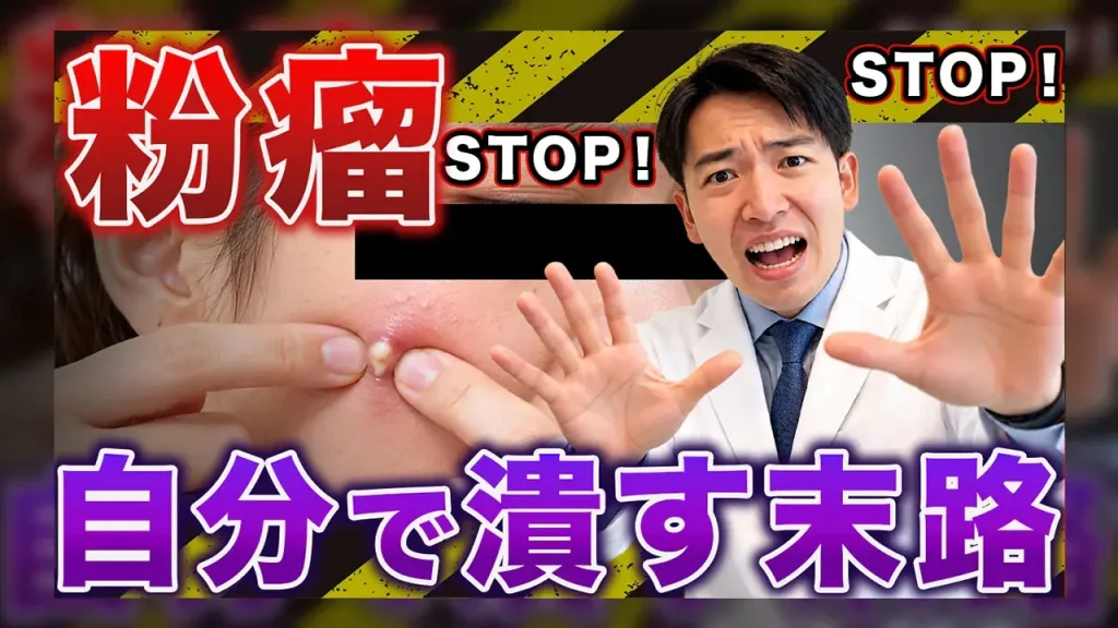 粉瘤を自分でつぶす末路