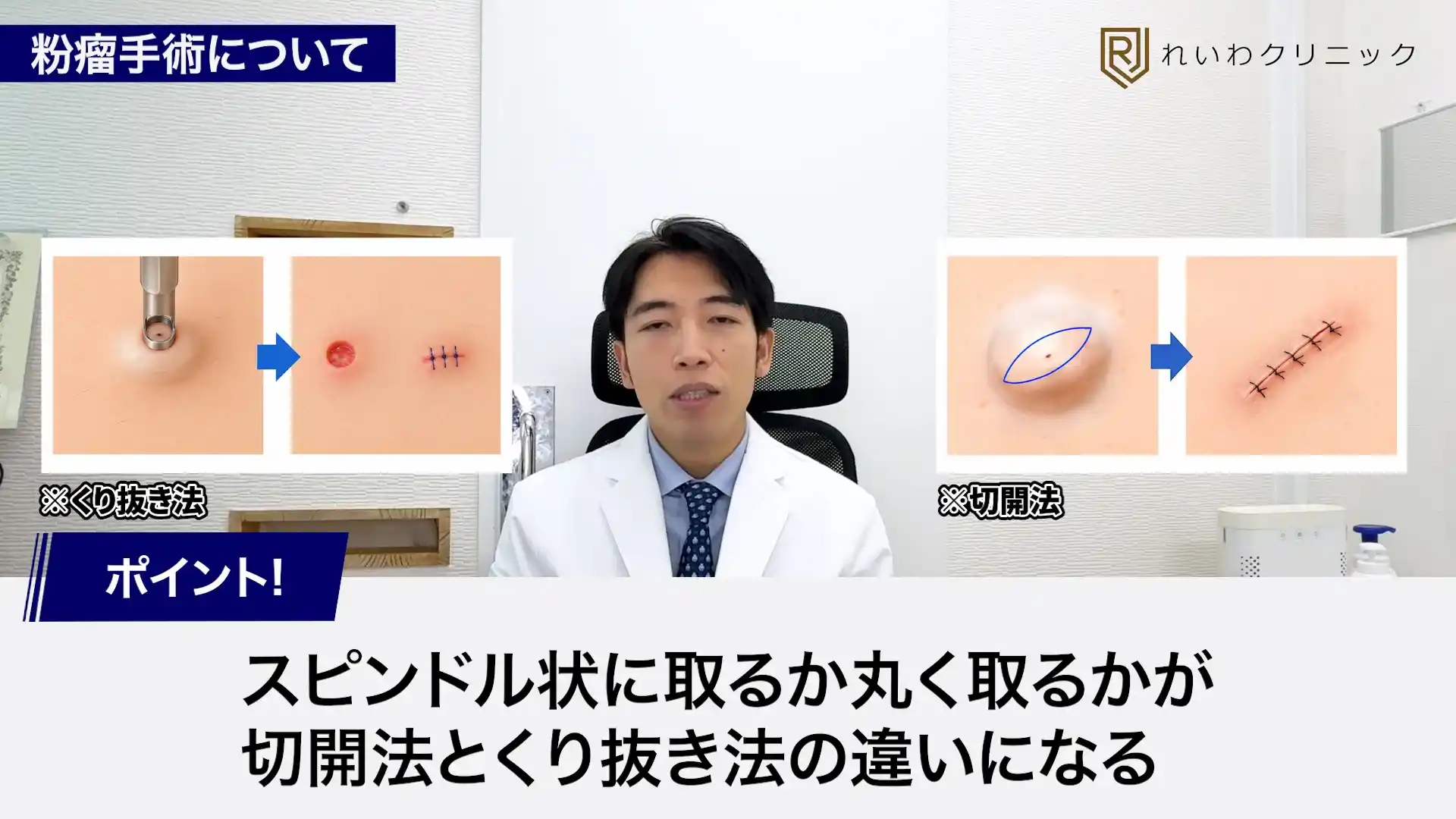 粉瘤手術でくり抜き法と切開法を選ぶ考え方を解説