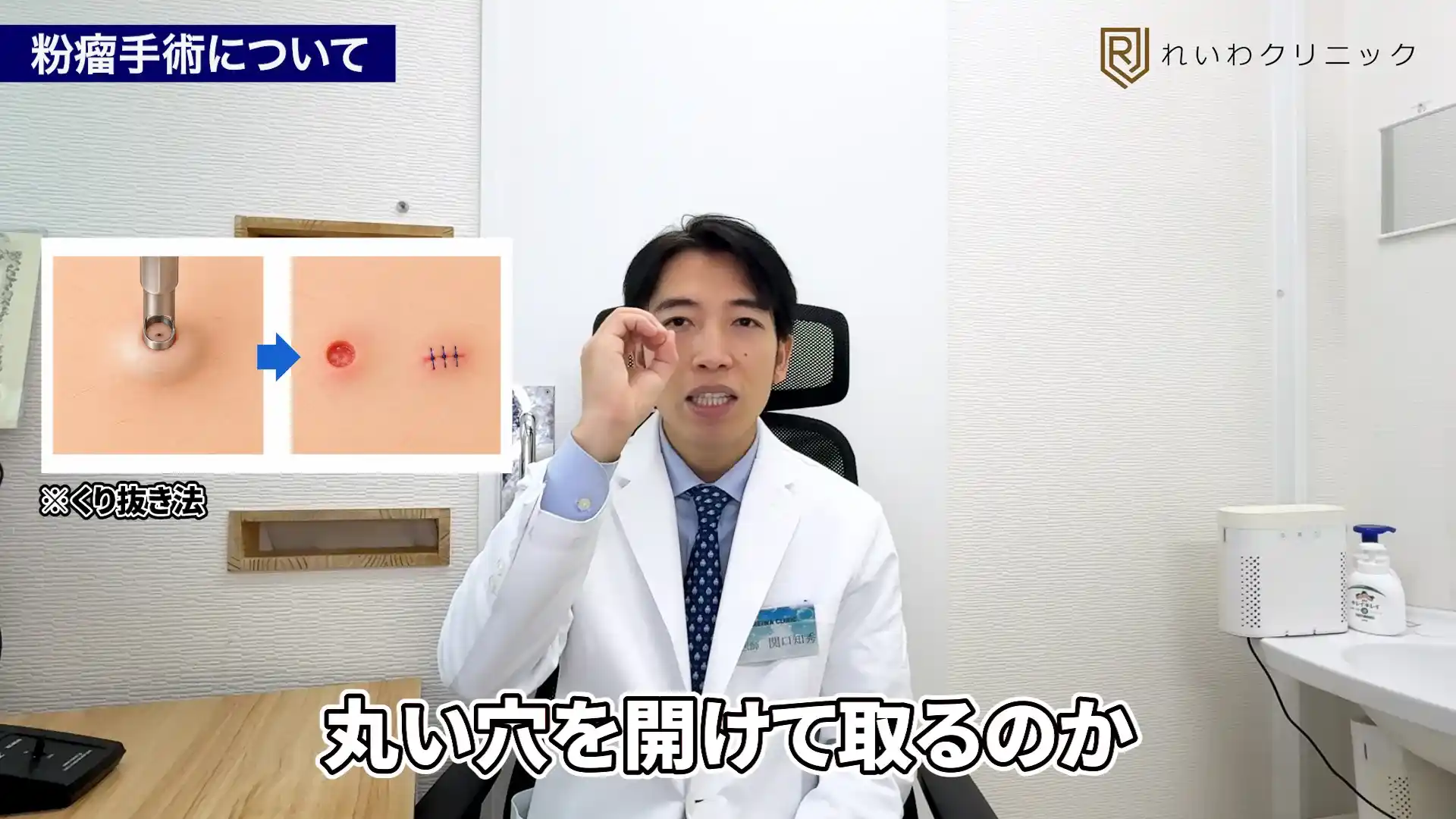 粉瘤を丸い開口部から取り除くくり抜き法の仕組みを解説