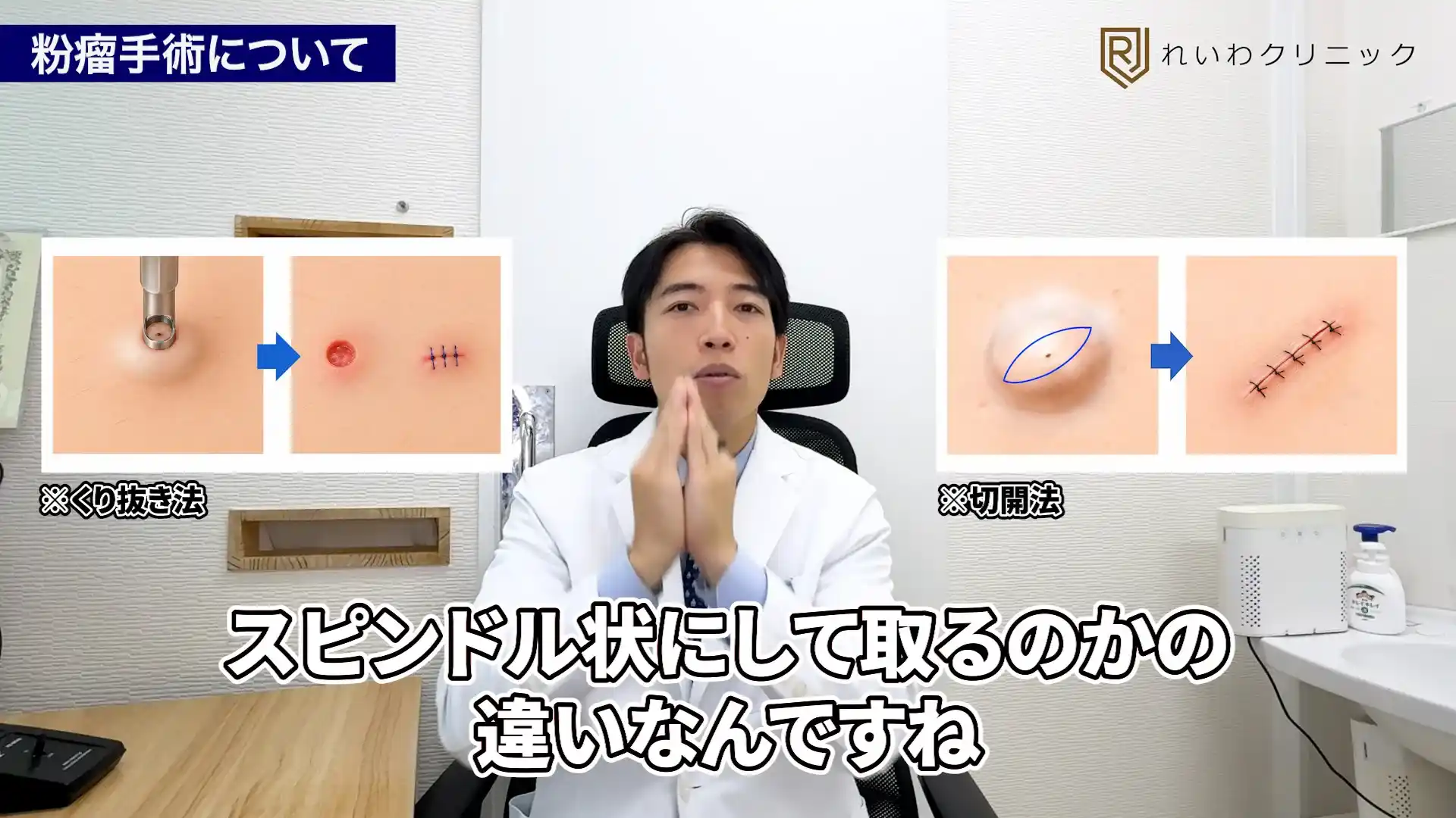 粉瘤を細長く切開して取り除く切開法の仕組みを解説