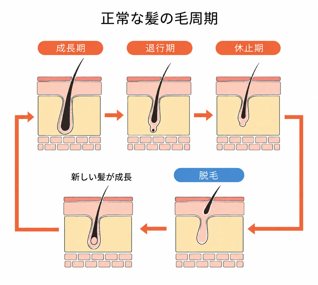 正常な髪の毛周期を示した図